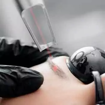 Laser treatment