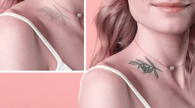 Tattoo fading